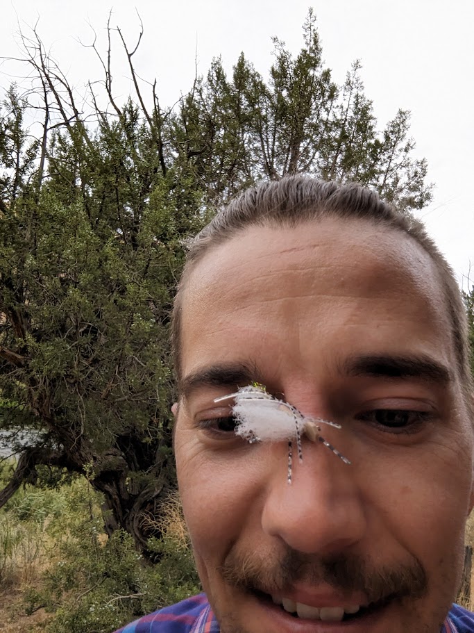 A picture of Wade with a fly hook in his nose